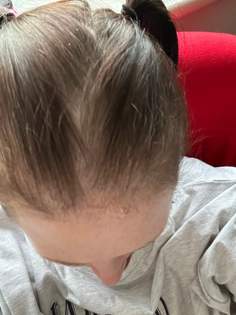 Month 3